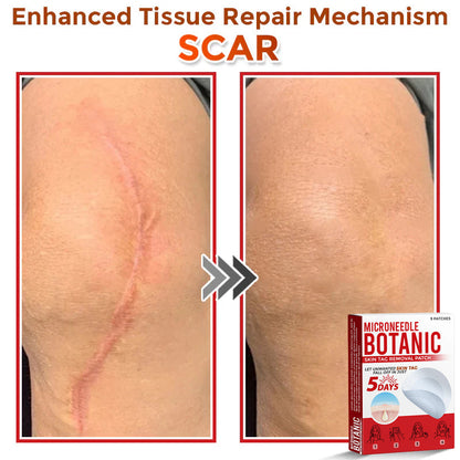 Microneedle Botanical Skin Tag Removal Patch 🇺🇸Made in the USA (FDA Certified)
