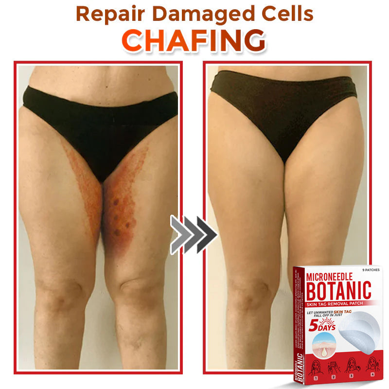 Microneedle Botanical Skin Tag Removal Patch 🇺🇸Made in the USA (FDA Certified)