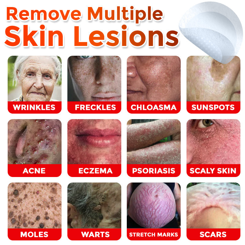 Microneedle Botanical Skin Tag Removal Patch 🇺🇸Made in the USA (FDA Certified)