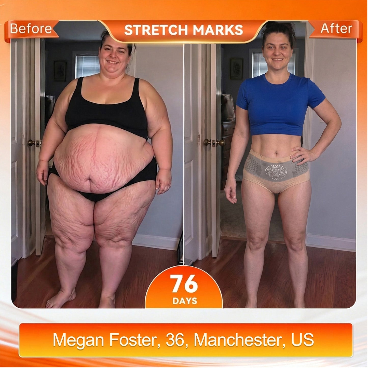 Us2026 Moringa& Berberine 4-In-1Micro Particle Sculpting& Fat-Burn Shorts